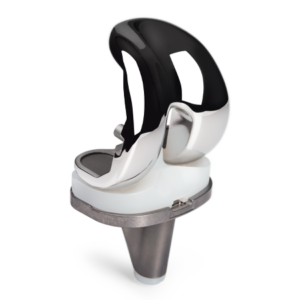 NexGen® Complete Knee Solution