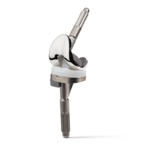 NexGen® Legacy® Constrained Condylar Knee (LCCK)