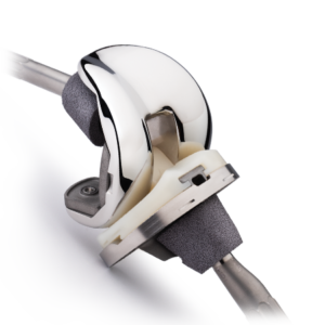 Persona® Revision Knee